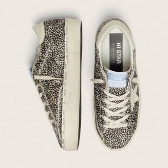 Golden Goose Hi Star In Black And White Pony Skin With White Leather Star Golden Goose Hi Star In Black And White Pony Skin With White Leather Star